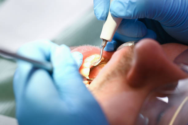 Best Emergency Treatment for Toothache in Venus, TX
