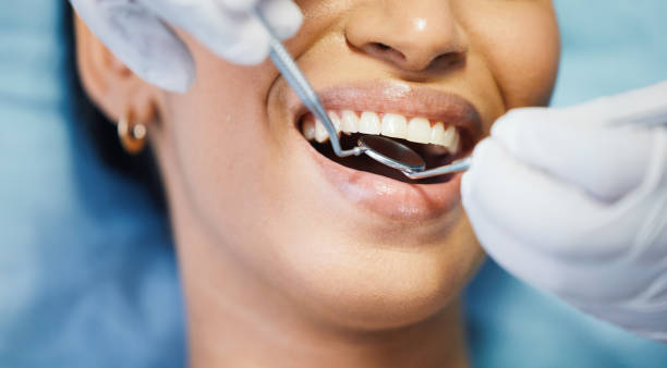 Best Emergency Broken Tooth Repair in Venus, TX