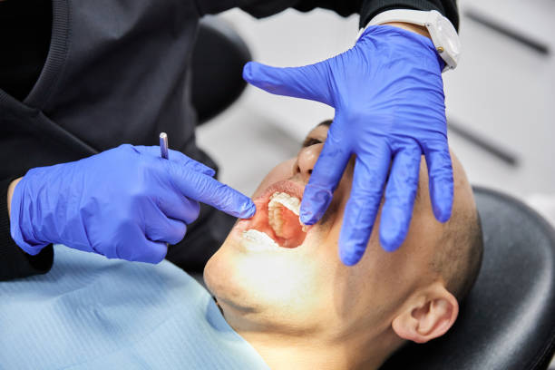 Best Emergency Treatment for Toothache in Venus, TX